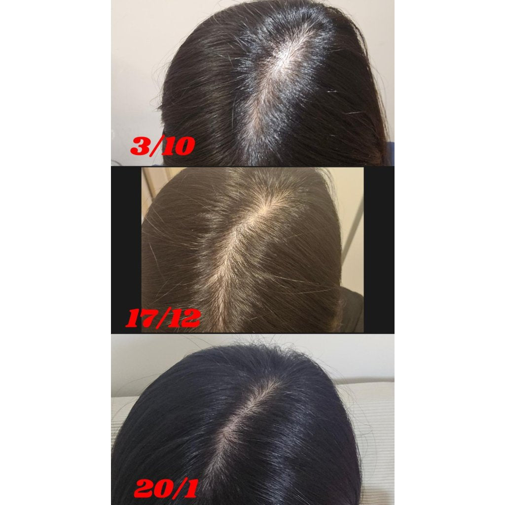 Folligrow Herbal Scalp Serum