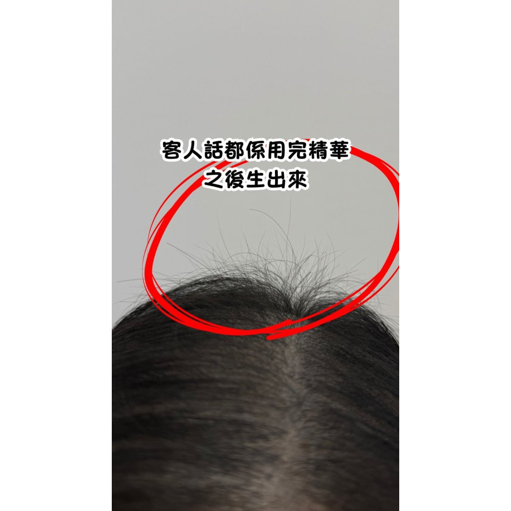 Folligrow Herbal Scalp Serum
