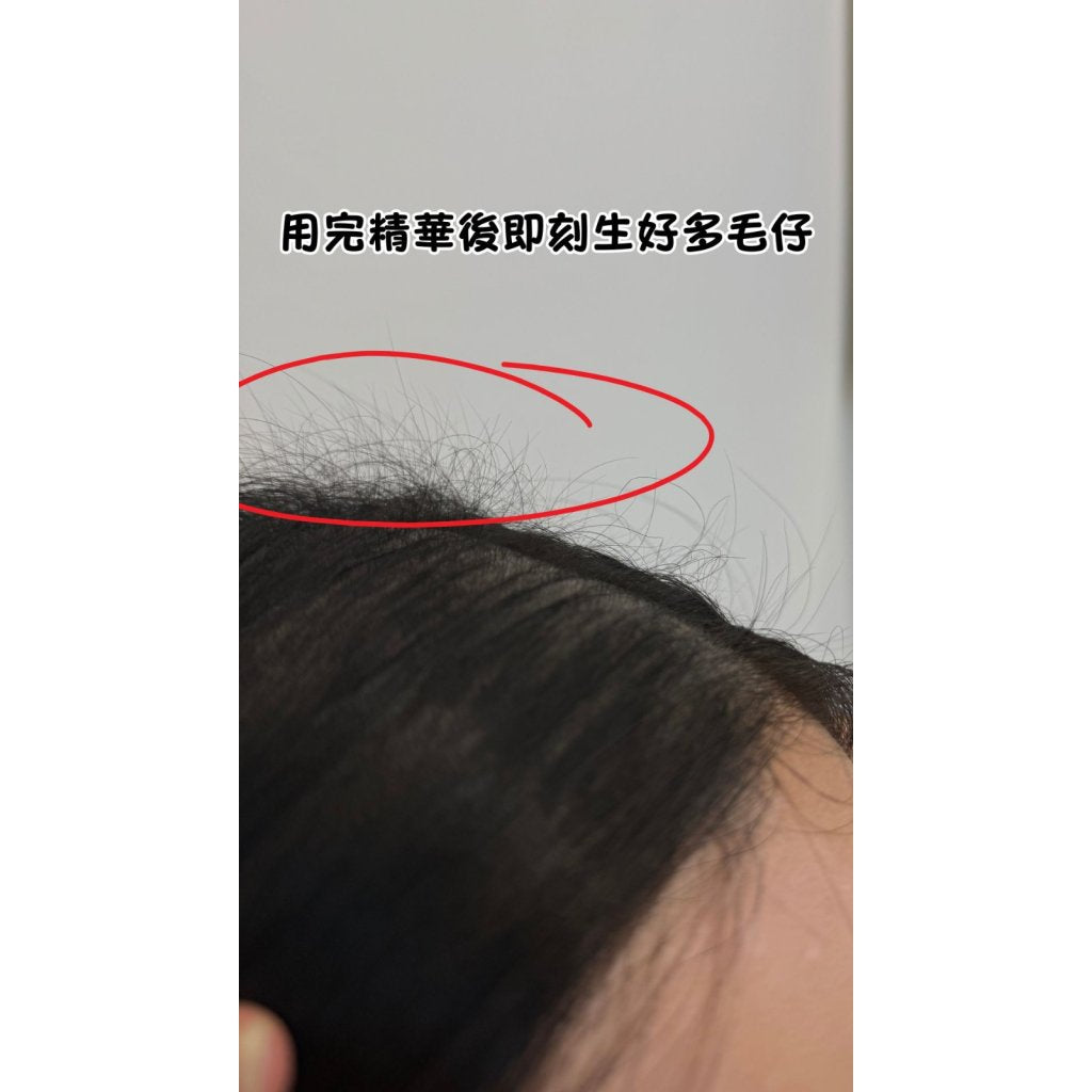 Folligrow Herbal Scalp Serum